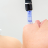 Microneedling Glow Therapy