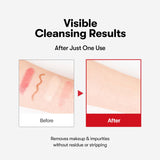 VT COSMETICS Azelaic Acid Cleansing Oil 200ml